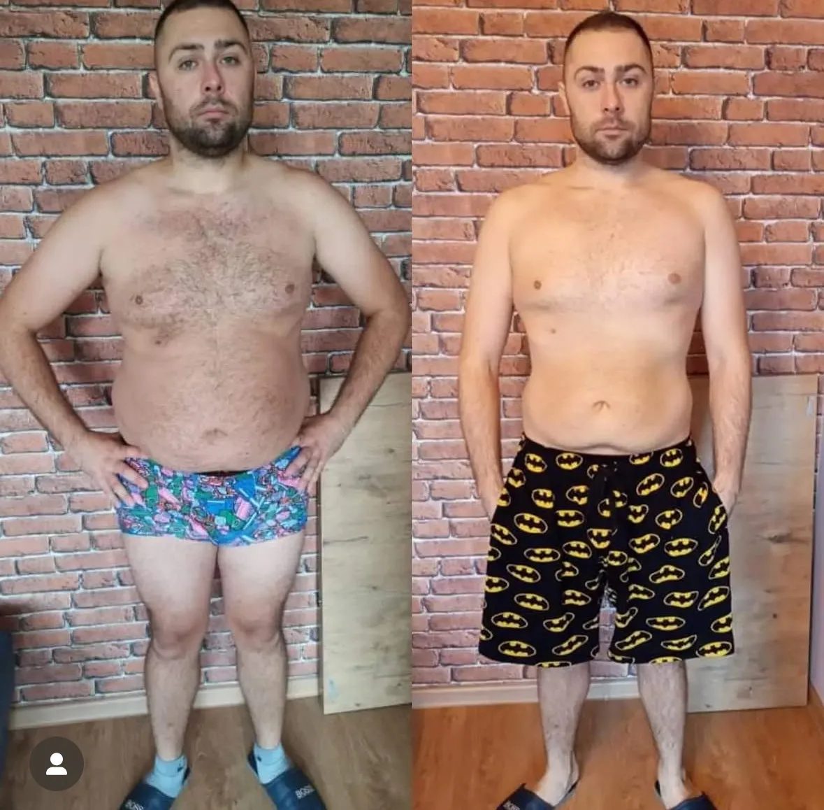 Transformacja podopiecznego 04 - efekt przed i po